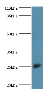 CALN1 Polyclonal Antibody