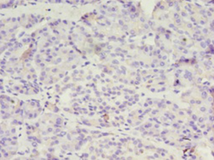 DPH1 Polyclonal Antibody