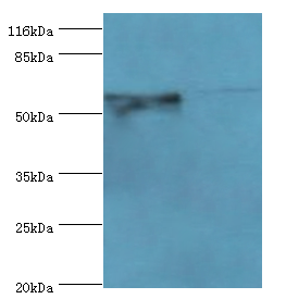 CYP4F11 Polyclonal Antibody (100 µl)