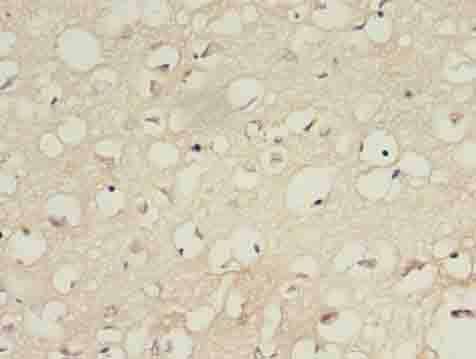 IFT27 Polyclonal Antibody