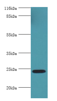 MIS12 Polyclonal Antibody