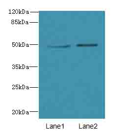 TUBB6 Polyclonal Antibody