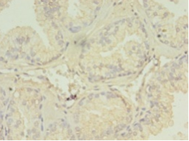 TRIM9 Polyclonal Antibody