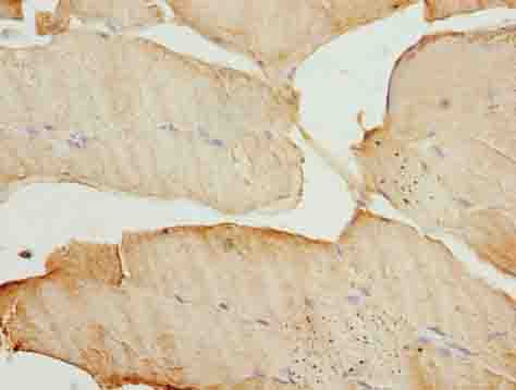 MAP1LC3A Polyclonal Antibody