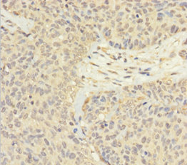 FAM60A Polyclonal Antibody