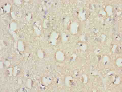 RABGEF1 Polyclonal Antibody