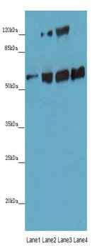 ANGPTL2 Polyclonal Antibody (100 µl)