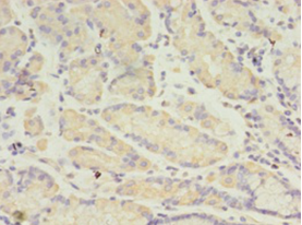 ANGPTL2 Polyclonal Antibody