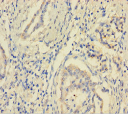 MCTS1 Polyclonal Antibody