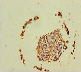 GINS2 Polyclonal Antibody