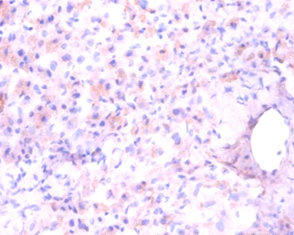 Immunohistochemistry of paraffin-embedded human liver tissue at dilution 1:100