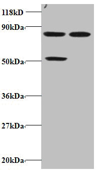 CCL22 Polyclonal Antibody (100 µl)