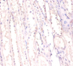 Immunohistochemistry of paraffin-embedded human kidney using FUS Polyclonal Antibody at dilution of 1:100