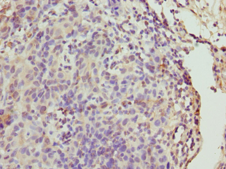 CALM1 Polyclonal Antibody