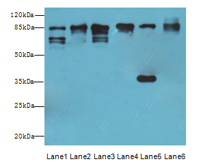 CTNNB1 Polyclonal Antibody