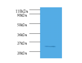 SRSF9 Polyclonal Antibody