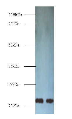 TAGLN Polyclonal Antibody