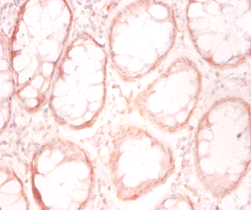 PFDN1 Polyclonal Antibody