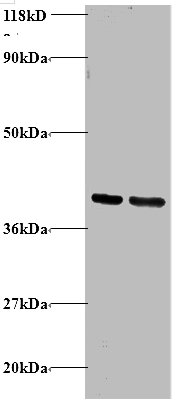 GDI2 Polyclonal Antibody (100 µl)