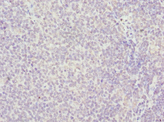HMGB1 Polyclonal Antibody
