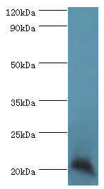 GM2A Polyclonal Antibody