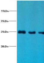 LCN2 Polyclonal Antibody