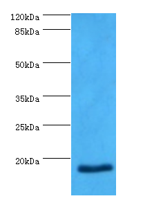NPPB Polyclonal Antibody