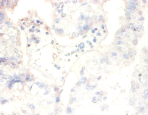 CSNK2B Polyclonal Antibody