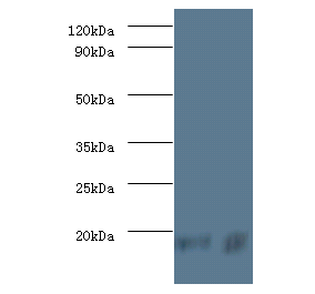 PFDN5 Polyclonal Antibody