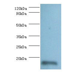 RPL36AL Polyclonal Antibody