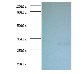 UQCRQ Polyclonal Antibody