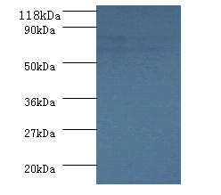 SDHA Polyclonal Antibody