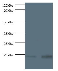 RPS13 Polyclonal Antibody