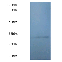 RPL5 Polyclonal Antibody