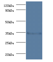 PPP2CB Polyclonal Antibody
