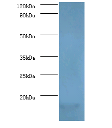 PMP2 Polyclonal Antibody