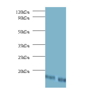 DAD1 Polyclonal Antibody