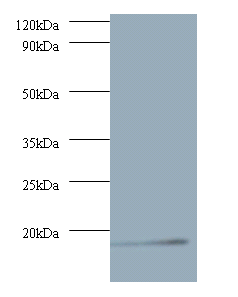 ATP6V1G1 Polyclonal Antibody