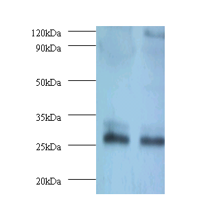 TPMT Polyclonal Antibody