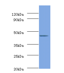 PSMD11 Polyclonal Antibody