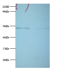 PGK1 Polyclonal Antibody