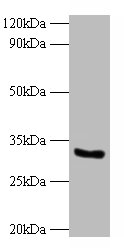CYB5R3 Polyclonal Antibody (100 µl)