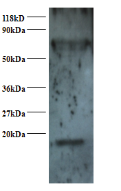 SNRPD2 Polyclonal Antibody