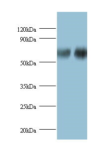 PHGDH Polyclonal Antibody