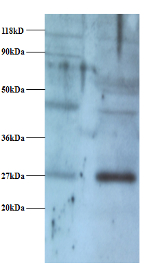 NDUFV2 Polyclonal Antibody