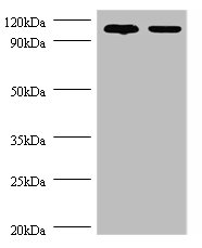 EXTL3 Polyclonal Antibody (100 µl)