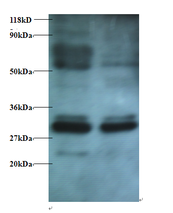 ERP29 Polyclonal Antibody