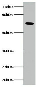 ARPC3 Polyclonal Antibody