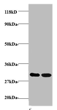 ARHGEF18 Polyclonal Antibody (100 µl)