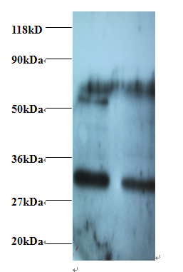 ARHGEF18 Polyclonal Antibody